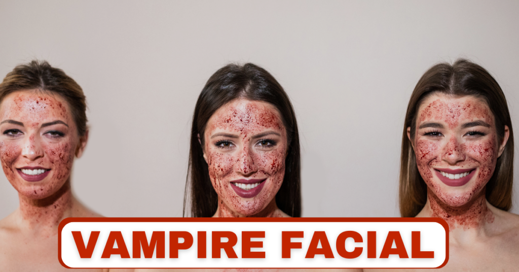 Vampire Facial Treatment