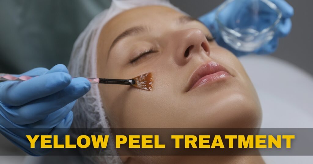What is Yellow Peel Treatment