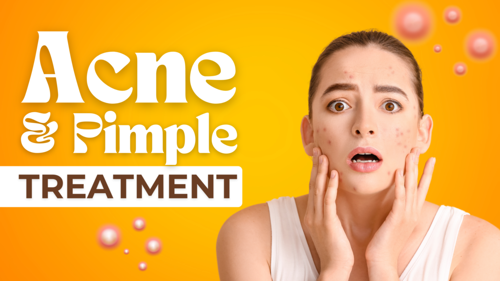 Acne and Pimple Treatment